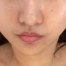 피부아지트(뉴페이스) 이미지