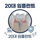 20 | 20대임플란트 후기 가격 비용 유의해야할 것