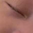 원주김안과의원 이미지