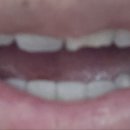 서울금플란트치과의원 이미지