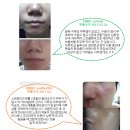 세라케어 이미지