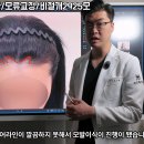 중앙헤어라인 티스토리