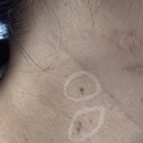 새론한방병원 이미지