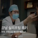 실 - 아산시 번영로217번길 28-3 | 강남 실리프팅 후기, 전후 사진으로 확인한 변화는?