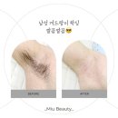 뷰티미우