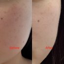 컴포즈커피 홍성내포점 | [충남 홍성] 숨결클렌징으로 피부관리 시작, ‘ 홍성 원뷰티스킨케어’ 방문후기