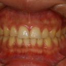 크라운치과기공소 이미지