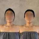 노원신부관리 뷰티라보앤유 SNPE 자세교정관리프로그램후기