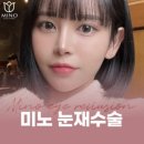 미노시스템 이미지