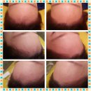퀸헤어라인 이미지