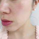 지구스피루리나 - 진주시 | 모델링팩추천 피부과모델링팩 Dr.SGN 스피루리나모델링팩 후기