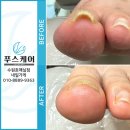 푸스케어 수원호매실점 이미지