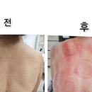 오늘은밝은피부 이미지