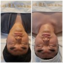 렛미인피부 이미지