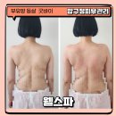 웰스코리아 | 압구정에스테틱 찾는다면? 등까지 풀어주는 액와관리 웰스파!