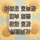 어성초 효능과 피부 염증 완화 효과 살펴보기
