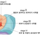 조은케어 이미지