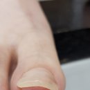 루덴네일