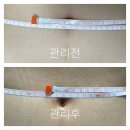 위더스사우나 | 용인 산후마사지 위더스산후케어에서 복직근관리 받고 -3cm 뱃살삭제한 후기