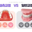 오라치과의원 티스토리
