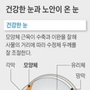 老眼의 모든 것. 특수렌즈 노안수술의 등장 이미지