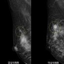 온유항외과의원 네이버블로그
