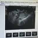 김란미즈산부인과의원 | 독산동 산부인과 제이미즈 산부인과 자궁경부암 초음파 후기