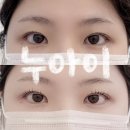 허리사랑병원 | [대전 서구] 대전 괴정동 속눈썹 내 눈에 꼭 맞춘 시그니처 클리닉펌 “누아이”