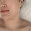 건영빌딩 | 청주작은얼굴관리 피부 힐에스테틱 후기