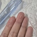 오운드 | [내돈내산] 구순염 치료 후기 | 입술 트고 변색 | 약 | 실비 정보