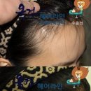 옥건헤어라인의원