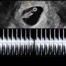 신세인 | [7주차 증상과 일상] 7주차 젤리곰, 동탄제일병원 신세인 과장님 진료후기
