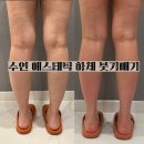 수연디톡스