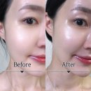 빨강이 | 코나피딜 어댑터 ES1 EH1 에센셜 차이 물세럼 사용법 후기
