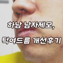 더 젠틀 호텔 | 하남미사 남자제모, 턱 여드름에 젠틀맥스프로 플러스 후기, 통증X