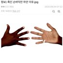 인종에 상관없이 손바닥이 하얀 이유 이미지