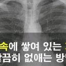 폐 속에 쌓여 있는 가래 말끔히 없애는 방법 이미지