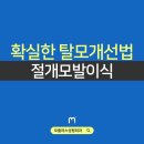 모플러스성형외과의원 | 확실한 탈모개선법 절개모발이식