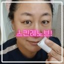 기미, 노화피부 천연 유기농 스킨레노브 리얼 후기