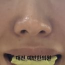 예반한의원 | 이명으로 대전 한의원 다녀온 내돈내산 후기 / Feat. 아빠도 이제 한계다 그냥 나가 살아라.