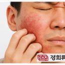 우선냉열 이미지