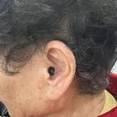 포낙보청기 대구중구센터 이미지