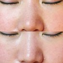 안산피부관리 고잔동 릿지뷰티에서 홍조잡은 1:1맞춤 관리 후기