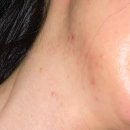 양준상의원 | 양준상의원 네번째 처방 후기