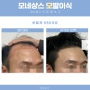 (주)모네상스 | 아직도! 비절개모발이식 후기를 찾고 계신가요? 모발이식만 3번한 11만 탈모카페 운영자가 글 하나로...