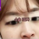 비씨아이성형외과의원