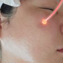 파밀리에펄시티 | [장산 피부관리] 미유미 에스테틱 플라즈마로 모공·탄력 한 번에 잡은 찐후기