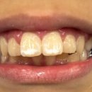 블랙벨트 한빛 태권도장 이미지