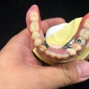 참진치과기공소 이미지