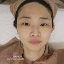 홍대 피부관리샵 원쎄라리프팅 솔직 후기 이소피부가꿈
